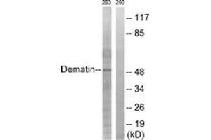 Western blot analysis of extracts from 293 cells, using Dematin (Ab-403) Antibody. (Dematin Antikörper  (AA 356-405))