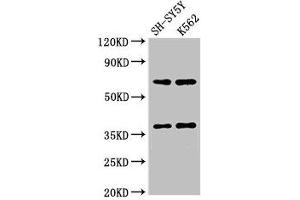 Cathepsin H Antikörper  (AA 116-219)