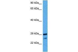 Western Blotting (WB) image for anti-NK2 Homeobox 2 (Nkx2-2) (N-Term) antibody (ABIN2779575)