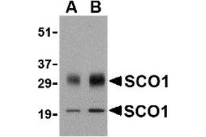 Western Blotting (WB) image for anti-SCO1 Cytochrome C Oxidase Assembly Protein (SCO1) (Middle Region) antibody (ABIN1031080) (SCO1 Antikörper  (Middle Region))