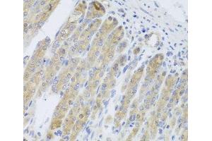Immunohistochemistry of paraffin-embedded Mouse stomach using RARS2 Polyclonal Antibody at dilution of 1:100 (40x lens). (RARS2 Antikörper)