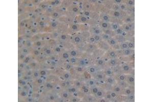 Used in DAB staining on fromalin fixed paraffin- embedded Kidney tissue (DDB2 Antikörper  (AA 212-407))
