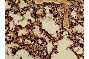 Immunohistochemistry of paraffin-embedded human lung tissue using ABIN7166683 at dilution of 1:100 (APOBEC4 Antikörper  (AA 221-367))