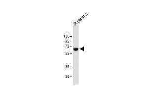Anti-T Antibody (Center) at 1:2000 dilution + Rat plasma whole lysate Lysates/proteins at 20 μg per lane. (PLAT Antikörper  (AA 371-399))