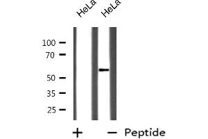 Western blot analysis of GABA-RB expression in HeLa whole cell lysates,The lane on the left is treated with the antigen-specific peptide. (GABA-RB Antikörper)