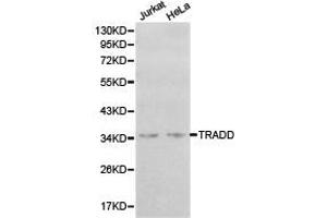 Western Blotting (WB) image for anti-TNFRSF1A-Associated Via Death Domain (TRADD) antibody (ABIN1875189) (TRADD Antikörper)