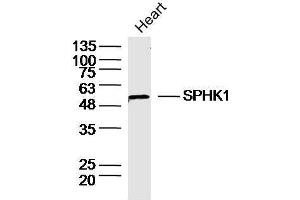 Mouse heart lysates probed with SPHK1 Polyclonal Antibody, unconjugated  at 1:30 overnight at 4°C followed by a conjugated secondary antibody at 1:10000 for 90 minutes at 37°C. (SPHK1 Antikörper  (AA 1-100))