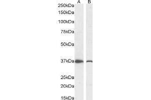 Western Blotting (WB) image for anti-Dimethylarginine Dimethylaminohydrolase 1 (DDAH1) (C-Term) antibody (ABIN184669)