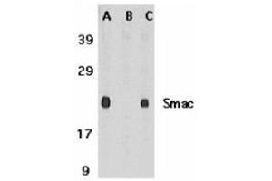 Western blot analysis of Smac in mouse heart tissue lysate in the absence (A) or presence (B) of blocking peptide and in rat heart tissue lysate with this product at 1 μg /ml. (DIABLO Antikörper  (C-Term))
