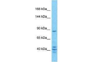 Host:  Rabbit  Target Name:  ZN160  Sample Type:  PANC1 Whole Cell lysates  Antibody Dilution:  1. (ZNF160 Antikörper  (C-Term))