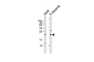 Epiregulin Antikörper  (C-Term)