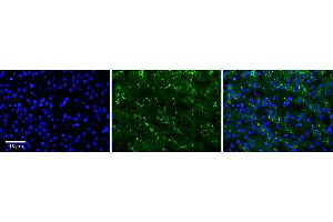 Rabbit Anti-ADCK2 Antibody  Catalog Number: ARP63131_P050 Formalin Fixed Paraffin Embedded Tissue: Human Adult Liver  Observed Staining: Membrane in bile canaliculi, strong signal, wide tissue distribution Primary Antibody Concentration: 1:100 Secondary Antibody: donkey anti-rabbit FITC Secondary Antibody Concentration: 1:200 Magnification: 20X Exposure Time: 0. (ADCK2 Antikörper  (Middle Region))