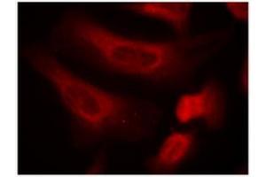 Image no. 3 for anti-Signal Transducer and Activator of Transcription 1, 91kDa (STAT1) (pSer727) antibody (ABIN196893) (STAT1 Antikörper  (pSer727))