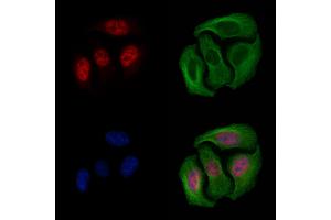ABIN6254904 and ABIN6267568 staining Hela cells by IF/ICC. (Histone 3 Antikörper  (H3K9ac))