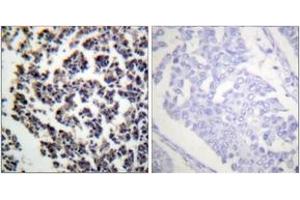 Immunohistochemistry analysis of paraffin-embedded human lymph node, using BLNK (Phospho-Tyr96) Antibody. (B-Cell Linker Antikörper  (pTyr96))