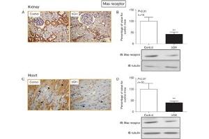 Expression of Angiotensin-(1-7) Mas Receptor in mouse heart and kidney.