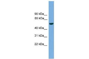 WB Suggested Anti-TMPRSS4 Antibody Titration:  0.