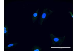Immunofluorescence of purified MaxPab antibody to ITGAV on HeLa cell. (CD51 Antikörper  (AA 1-1048))