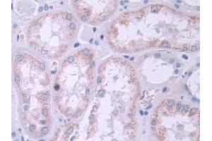 IHC-P analysis of Human Kidney Tissue, with DAB staining. (TRPC6 Antikörper  (AA 1-192))