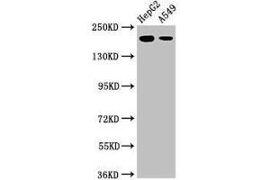 Western Blot Positive WB detected in: HepG2 whole cell lysate, A549 whole cell lysate All lanes: LRRK1 antibody at 3 μg/mL Secondary Goat polyclonal to rabbit IgG at 1/50000 dilution Predicted band size: 226, 29 kDa Observed band size: 226 kDa (LRRK1 Antikörper  (AA 1-68))