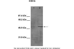 Lanes:  1. (IKBKG Antikörper  (Middle Region))