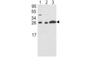 Western Blotting (WB) image for anti-rho GDP Dissociation Inhibitor (GDI) alpha (ARHGDIA) antibody (ABIN3001701)