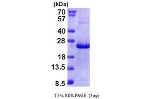 SDS-PAGE (SDS) image for Nescient Helix Loop Helix 2 (NHLH2) (AA 1-135) protein (His tag) (ABIN5853005)