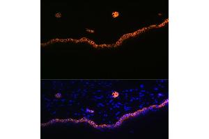 Immunofluorescence analysis of rat skin using Cytokeratin 15 (KRT15) (KRT15) Rabbit mAb (ABIN7268093) at dilution of 1:100 (40x lens). (KRT15 Antikörper)