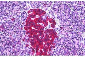 Human Pancreas, Islets of Langerhans: Formalin-Fixed, Paraffin-Embedded (FFPE)
