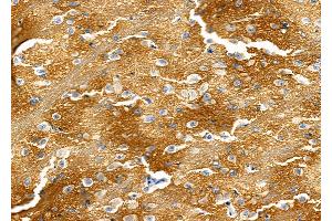 ABIN6265356 and ABIN6277579 at 1/100 staining Rat brain tissue by IHC-P.
