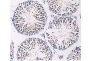 IHC-P analysis of Mouse Testis Tissue, with DAB staining. (SERPING1 Antikörper  (AA 397-495))