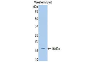 Western Blotting (WB) image for anti-ADAM Metallopeptidase with Thrombospondin Type 1 Motif, 1 (ADAMTS1) (AA 855-968) antibody (ABIN2906553)