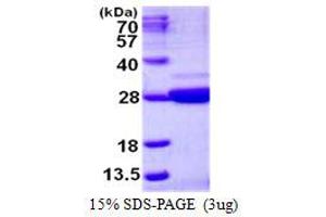 Image no. 1 for Nicotinamide Riboside Kinase 1 (NMRK1) protein (His tag) (ABIN1098295) (NMRK1 Protein (His tag))