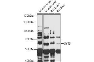Western blot analysis of extracts of various cell lines, using SYT3 antibody (ABIN7270674) at 1:1000 dilution. (Synaptotagmin 3 Antikörper  (AA 449-590))