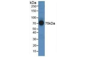 Detection of AFM in Human Serum using Polyclonal Antibody to Afamin (AFM) (Afamin Antikörper  (AA 211-403))