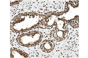 IHC analysis of TET1 using anti TET1 antibody (ABIN7600442). (TET1 Antikörper  (AA 194-417))