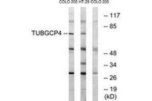 Western blot analysis of extracts from COLO/HT-29 cells, using TUBGCP4 Antibody. (TUBGCP4 Antikörper  (AA 191-240))