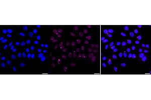 Immunocytochemical staining of HepG2 cells with Ribosomal protein S6 kinase A3 antibody (ABIN7800233), 1:1,000).