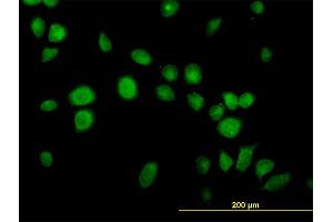 Immunofluorescence of monoclonal antibody to USP14 on HeLa cell. (USP14 Antikörper  (AA 395-494))