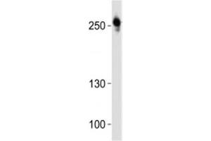 Western blot analysis of lysate from U-87 MG cell line using ROS1 antibody at 1:1000.