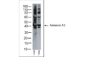 Rabbit anti Annexin A1 on human tonsil lysate (Annexin a1 Antikörper)
