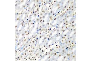 Immunohistochemistry of paraffin-embedded mouse kidney using SF3B3/S antibody (ABIN6128696, ABIN6147668, ABIN6147669 and ABIN6221751) at dilution of 1:200 (40x lens). (SF3B3 Antikörper  (AA 948-1217))