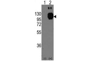 Image no. 1 for anti-Cadherin 13 (CDH13) (C-Term) antibody (ABIN356921) (Cadherin 13 Antikörper  (C-Term))