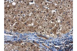 Immunohistochemistry (IHC) image for anti-Proteasome (Prosome, Macropain) 26S Subunit, ATPase, 5 (PSMC5) (Center) antibody (ABIN2856087)