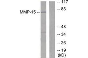Western Blotting (WB) image for anti-Matrix Metallopeptidase 15 (Membrane-inserted) (MMP15) (AA 611-660) antibody (ABIN2889229) (MMP15 Antikörper  (AA 611-660))
