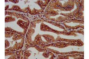 IHC image of ABIN7175101 diluted at 1:200 and staining in paraffin-embedded human prostate tissue performed on a Leica BondTM system. (SLC14A1 Antikörper  (AA 1-51))