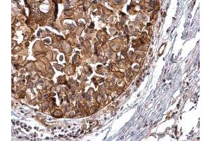 Immunohistochemistry (IHC) image for anti-Protein Kinase D2 (PKD2) antibody (ABIN2855325)