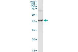 Western Blotting (WB) image for anti-Glutamic-Oxaloacetic Transaminase 1, Soluble (Aspartate Aminotransferase 1) (GOT1) (AA 1-413) antibody (ABIN516133)