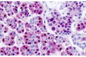 Human Pancreas: Formalin-Fixed, Paraffin-Embedded (FFPE) (NANS Antikörper)