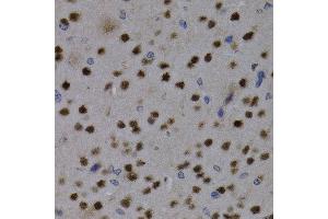 Immunohistochemistry (IHC) image for anti-Myocyte Enhancer Factor 2C (MEF2C) (AA 170-380) antibody (ABIN3023394) (MEF2C Antikörper  (AA 170-380))